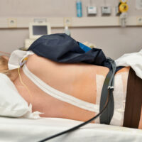 New York City Epidural Injection New York City Epidural Injection
